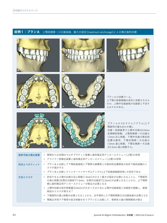 Journal of Aligner Orthodontics 日本版 2023年No4