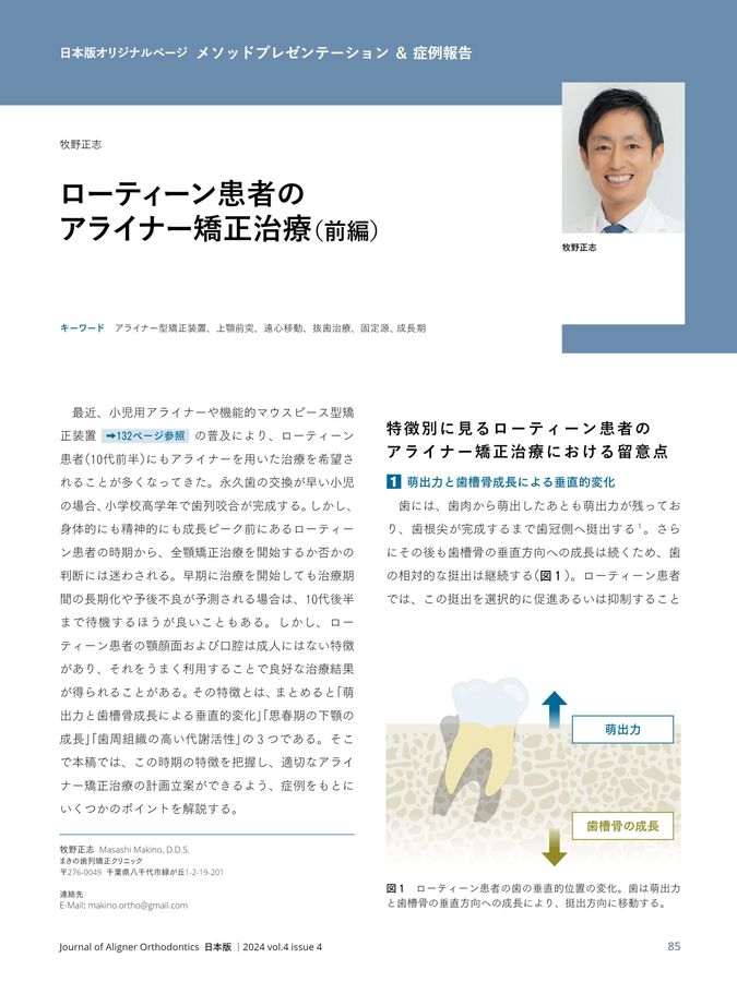 歯の移動の臨床バイオメカニクス : 骨と歯根膜のダイナミズム 歯の移動の臨床バイオメカニクス 骨と歯根膜のダイナミズム/医歯
