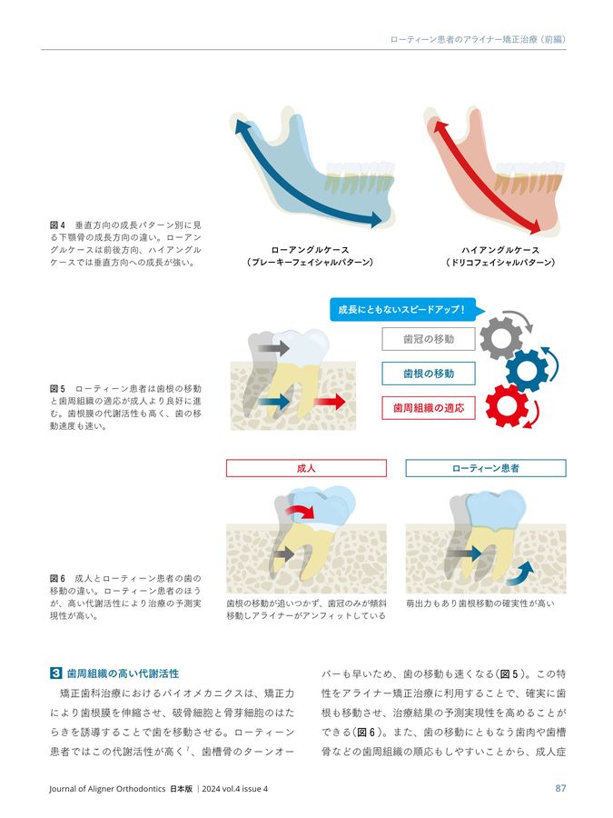 歯の移動の臨床バイオメカニクス : 骨と歯根膜のダイナミズム 歯の移動の臨床バイオメカニクス―骨と歯根膜のダイナミズム