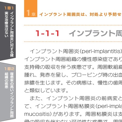 【新品】インプラント周囲炎 予防マニュアル インプラント周囲炎 予防マニュアル | DentalMovie 歯科医師向け