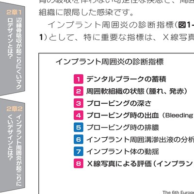 【新品】インプラント周囲炎 予防マニュアル インプラント周囲炎の予防と対策｜まつもと歯科吹田本院 よく
