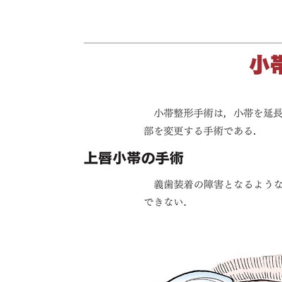 イラストでみる口腔外科手術 第3巻