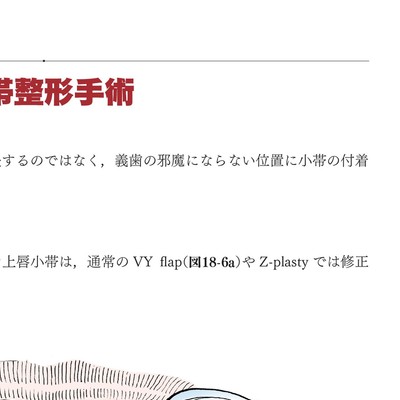 イラストでみる口腔外科手術 第3巻