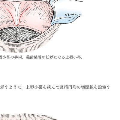 イラストでみる口腔外科手術 イラストでみる口腔外科手術 第1巻 | 野間 弘康, 福田 仁一