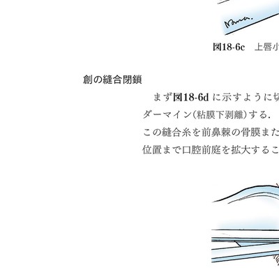 イラストでみる口腔外科手術 第3巻
