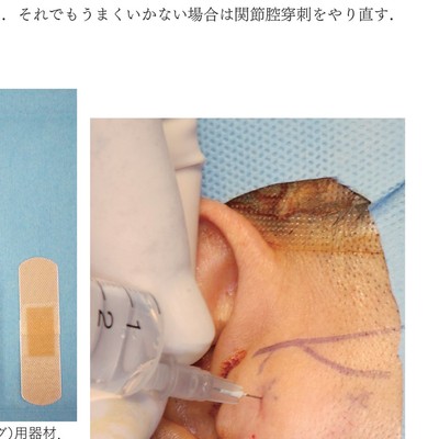 イラストでみる口腔外科手術 第3巻 イラストでみる口腔外科手術 第3巻 | 日本口腔外科学会, 野間