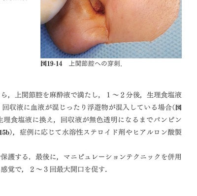 イラストでみる口腔外科手術 第3巻