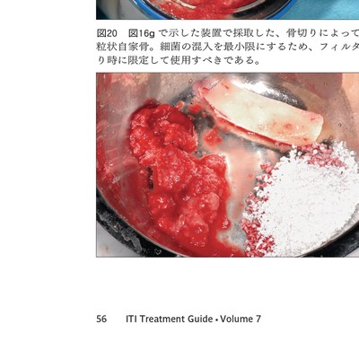 ITI Treatment Guide Volume 7