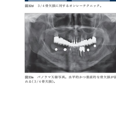 ♠裁断済 ITI Treatment Guide : Volume 7 ITI Treatment Guide Volume 7