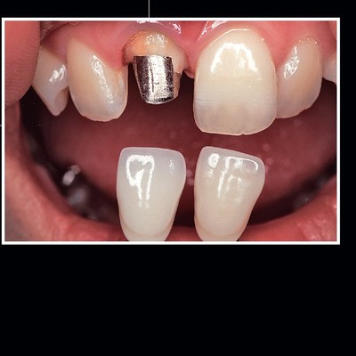 青嶋仁 歯科技工臨床写真集 ザ・セラミックワークス