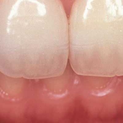 青嶋仁 歯科技工臨床写真集 ザ・セラミックワークス