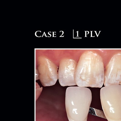 青嶋仁 歯科技工臨床写真集 ザ・セラミックワークス