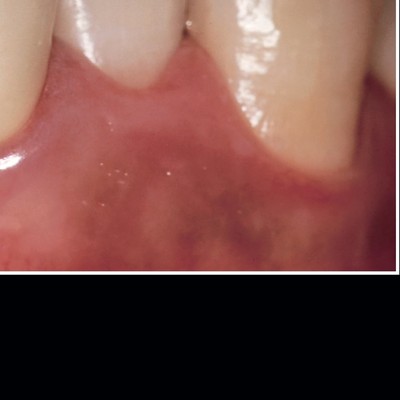 青嶋仁 歯科技工臨床写真集 ザ・セラミックワークス