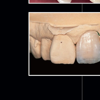 青嶋仁 歯科技工臨床写真集 ザ・セラミックワークス