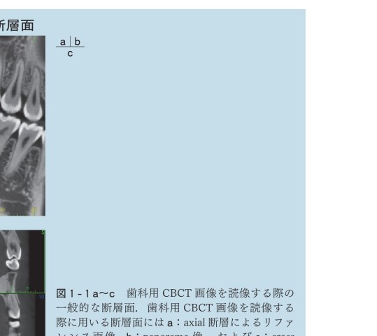 今さら聞けない歯科用CBCTとCTの読像法