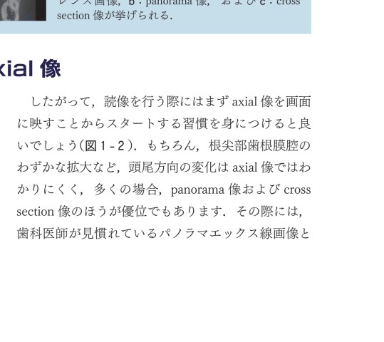 今さら聞けない歯科用CBCTとCTの読像法