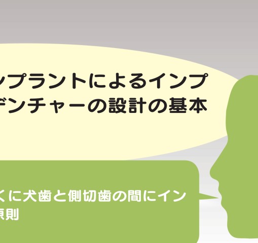 インプラントオーバーデンチャーの臨床とエビデンスQ＆A