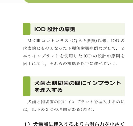 インプラントオーバーデンチャーの臨床とエビデンスQ&A インプラントオーバーデンチャーの臨床とエビデンスQ&A