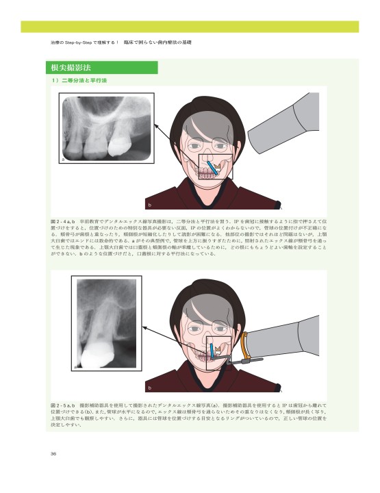 臨床で困らない歯内療法の基礎