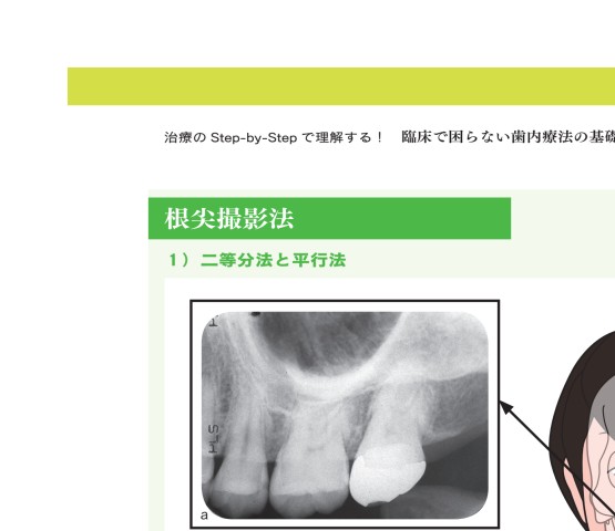 臨床で困らない歯内療法の基礎