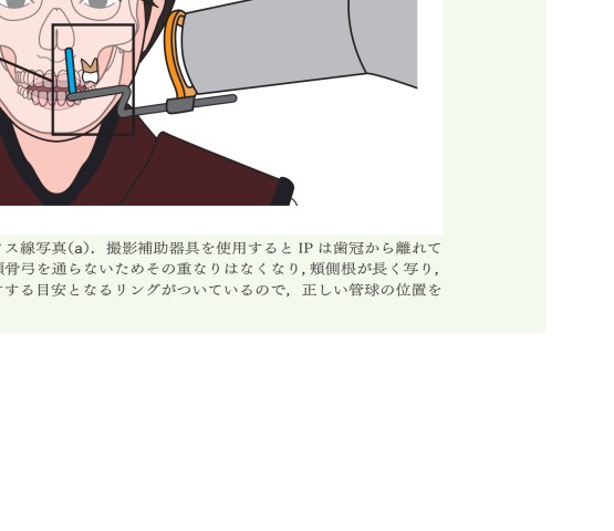 臨床で困らない歯内療法の基礎 臨床で困らない歯内療法の基礎 | 吉岡 隆知 |本 | 通販 | Amazon
