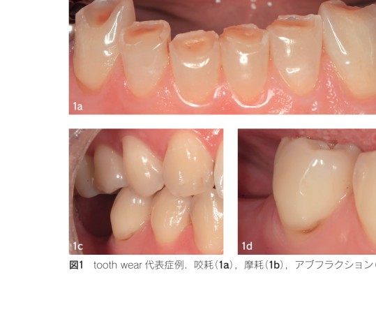 【即日発送】知る・診る・対応する 酸蝕症 知る・診る・対応する 酸蝕症｜医学、薬学、看護