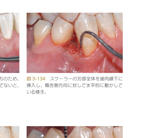 ●裁断済 歯科衛生士の力でここまでできる 非外科的歯周治療 歯科衛生士の力でここまでできる 非外科的歯周治療 | Marisa