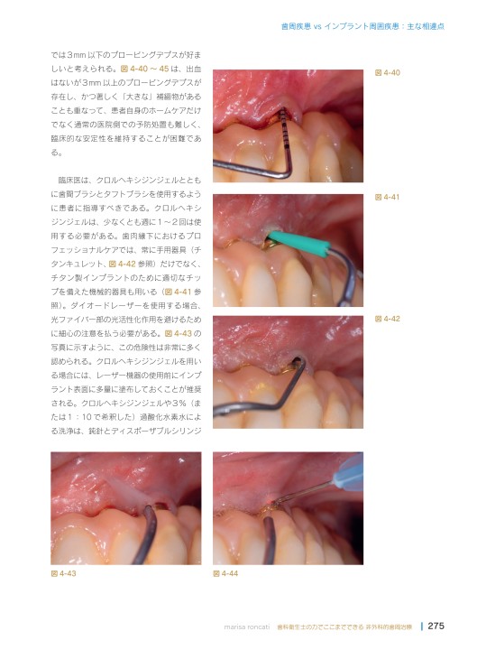 歯科衛生士の力でここまでできる 非外科的歯周治療