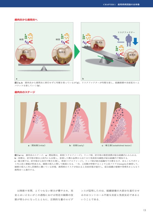 GPとDHのためのぺリオドントロジー2