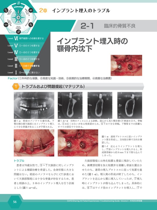 SAFE Troubleshooting Guide Volume 3 外科的合併症編