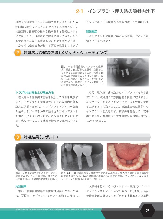 SAFE Troubleshooting Guide Volume 3 外科的合併症編