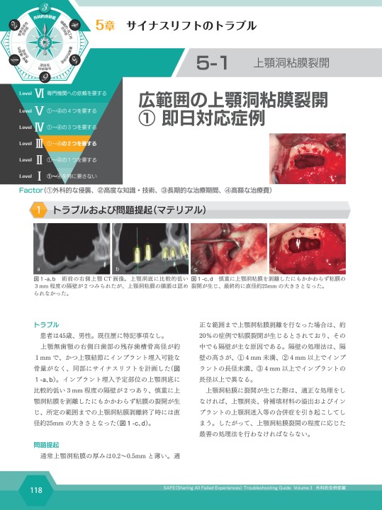 SAFE Troubleshooting Guide Volume 3 外科的合併症編