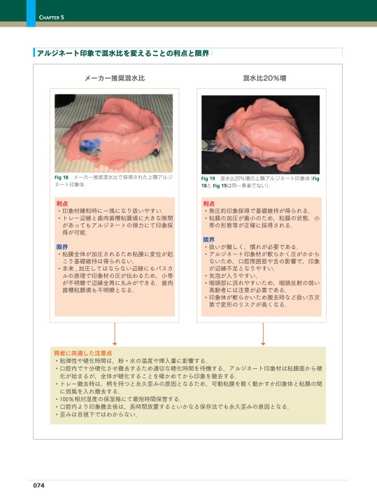 生体に優しい総義歯製作法