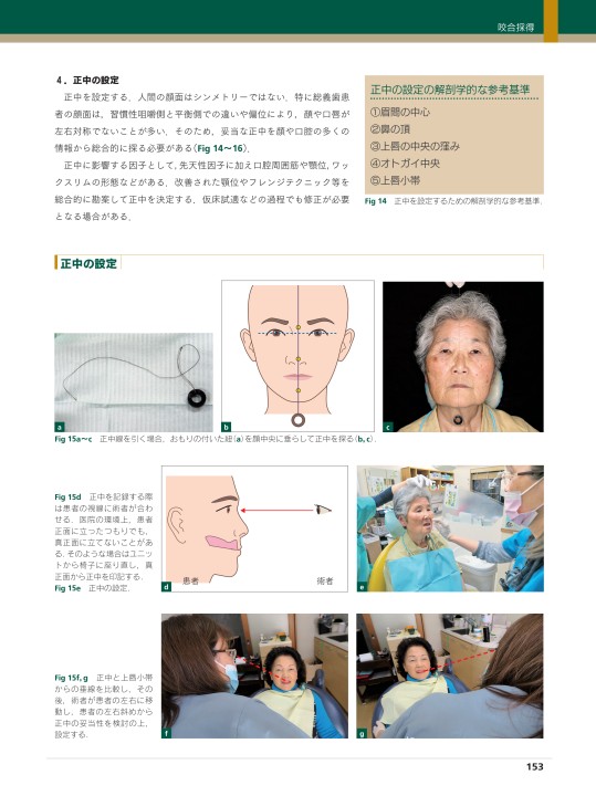 生体に優しい総義歯製作法
