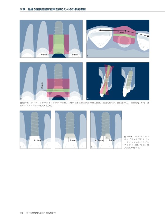 x1.jpg?c=201807031338400900