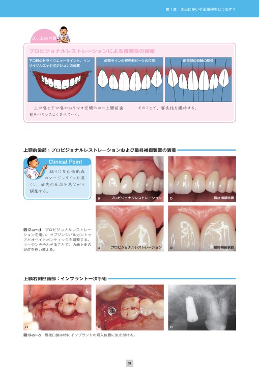 実践 咬合再構成を極める