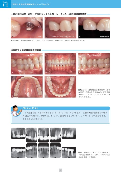 実践 咬合再構成を極める