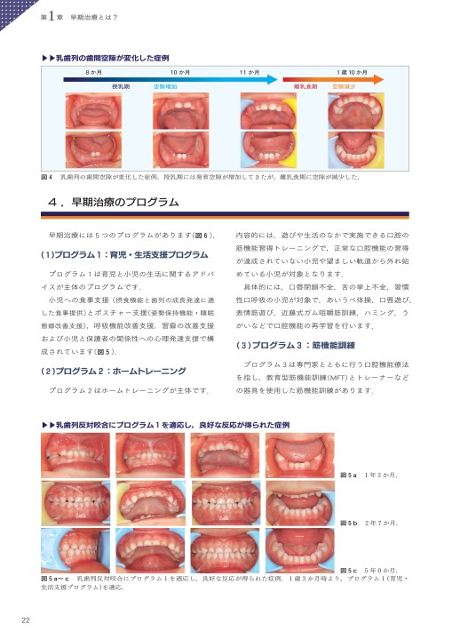 GP・小児・矯正が共に考える 実践早期治療