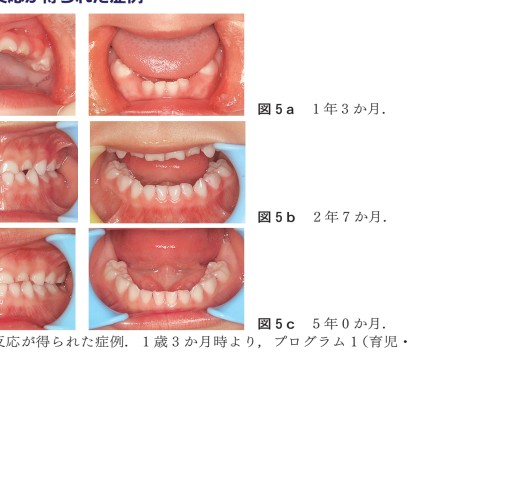 GP・小児・矯正が共に考える 実践早期治療
