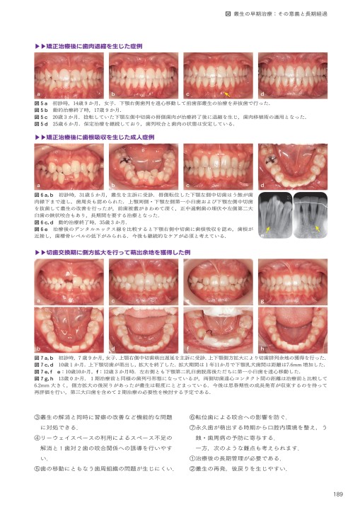 GP・小児・矯正が共に考える 実践早期治療