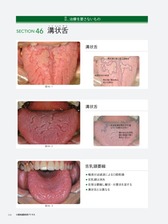 新版 チェアサイド・介護で役立つ 口腔粘膜疾患アトラス