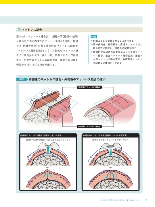 歯周外科ベーシックテクニック もっと上達したい人のためのポイント解説