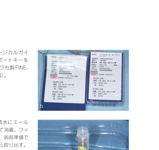 やさしいインプラント治療 初めての1本埋入をガイドします! やさしいインプラント治療 初めての1本埋入をガイドします！