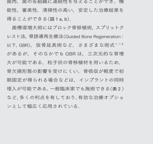 図解！遅延型吸収性膜を用いた 安全安心GBR