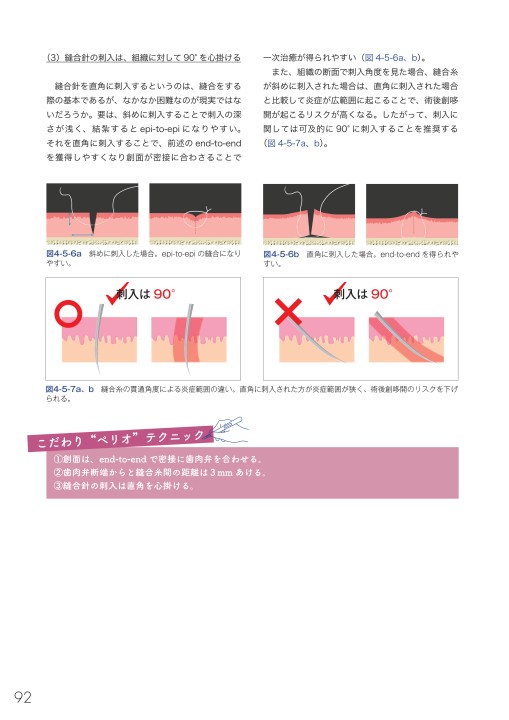驚くほど臨床が変わる！ こだわりペリオサブノート