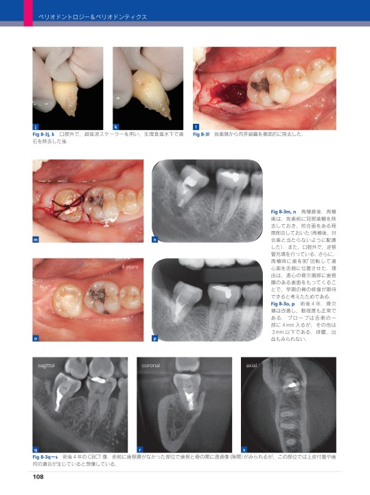 シリーズMIに基づく歯科臨床 vol.05 ペリオドントロジー＆ペリオドン