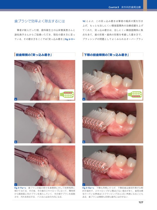 シリーズMIに基づく歯科臨床 vol.05 ペリオドントロジー＆ペリオドン