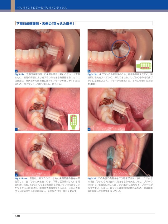 シリーズMIに基づく歯科臨床 vol.05 ペリオドントロジー＆ペリオドン