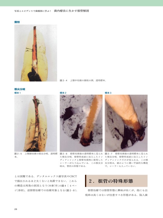 写真とエビデンスで歯種別に学ぶ！歯内療法に生かす根管解剖