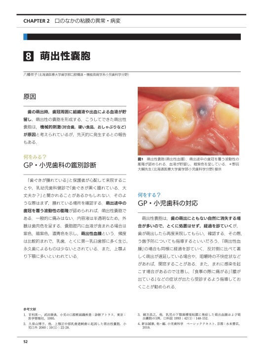 子どもの口と顎の異常・病変 口の粘膜 編